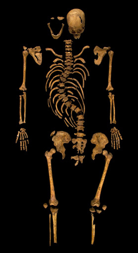 Illustration for article titled Tényleg gerincferdülése volt III. Richárdnak, de púpos az nem volt